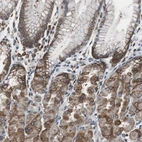 Immunohistochemical staining of human stomach shows moderate cytoplasmic positivity in glandular cells.