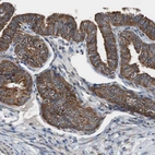 Immunohistochemical staining of human Fallopian tube shows strong cytoplasmic positivity in glandular cells.