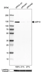 Western blot analysis in MCF-7 cells transfected with control siRNA, target specific siRNA probe #1 and #2, using Anti-USP10 antibody. Remaining relative intensity is presented. Loading control: Anti-GAPDH.