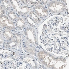 Immunohistochemical staining of human kidney shows low expression as expected.
