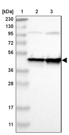 Lane 1: Marker [kDa] 230, 130, 95, 72, 56, 36, 28, 17, 11_br/_Lane 2: Human cell line RT-4_br/_Lane 3: Human cell line U-251MG sp