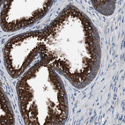 Immunohistochemical staining of human prostate shows strong cytoplasmic positivity in glandular cells.