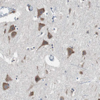 Anti-USP10 Antibody