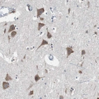 Immunohistochemical staining of human cerebral cortex shows moderate cytoplasmic positivity in neurons.