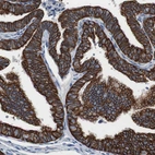 Immunohistochemical staining of human Fallopian tube shows strong cytoplasmic positivity in glandular cells.
