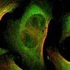 Immunofluorescent staining of human cell line U-2 OS shows localization to nucleoplasm & cytosol.