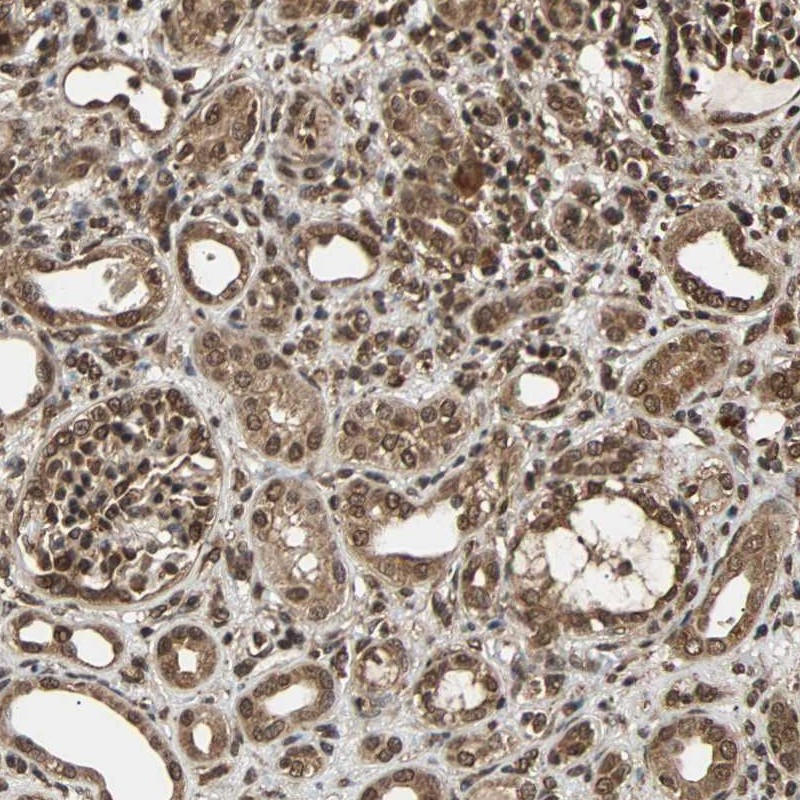 Anti-USP42 Antibody