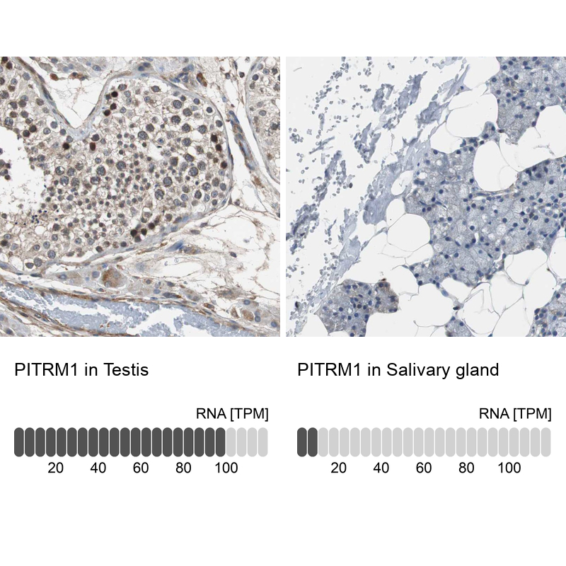 Anti-PITRM1 Antibody