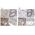 Anti-PITRM1 Antibody