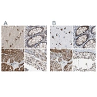 Immunohistochemical staining of human cerebral cortex, colon, heart muscle and testis using Anti-PITRM1 antibody HPA006753 (A) shows similar protein distribution across tissues to independent antibody HPA006754 (B).