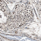 Immunohistochemical staining of human testis shows high expression.