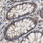 Immunohistochemical staining of human colon using Anti-PITRM1 antibody HPA006753.