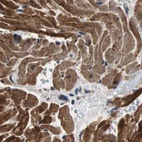 Anti-PITRM1 Antibody