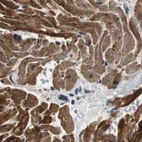 Immunohistochemical staining of human heart muscle using Anti-PITRM1 antibody HPA006753.