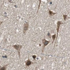 Immunohistochemical staining of human cerebral cortex using Anti-PITRM1 antibody HPA006753.