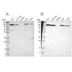 Anti-PITRM1 Antibody