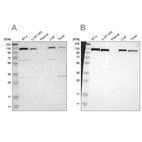 Western blot analysis using Anti-PITRM1 antibody HPA006753 (A) shows similar pattern to independent antibody HPA006754 (B).