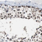 Anti-PITRM1 Antibody