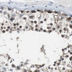 Immunohistochemical staining of human testis using Anti-PITRM1 antibody HPA006754.