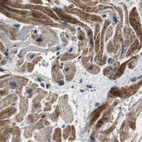 Immunohistochemical staining of human heart muscle using Anti-PITRM1 antibody HPA006754.
