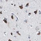Immunohistochemical staining of human cerebral cortex using Anti-PITRM1 antibody HPA006754.