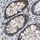 Immunohistochemical staining of human colon using Anti-PITRM1 antibody HPA006754.