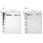 Western blot analysis using Anti-PITRM1 antibody HPA006754 (A) shows similar pattern to independent antibody HPA006753 (B).