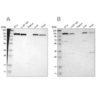 Western blot analysis using Anti-PITRM1 antibody HPA006754 (A) shows similar pattern to independent antibody HPA006753 (B).