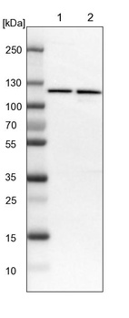 Lane 1: NIH-3T3 cell lysate (Mouse embryonic fibroblast cells)_br/_Lane 2: NBT-II cell lysate (Rat Wistar bladder tumour cells)