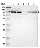 Lane 1: Marker [kDa] 230, 130, 95, 72, 56, 36, 28, 17, 11_br/_Lane 2: Human cell line RT-4_br/_Lane 3: Human cell line U-251MG sp_br/_Lane 4: Human plasma (IgG/HSA depleted)_br/_Lane 5: Human liver tissue_br/_Lane 6: Human tonsil tissue