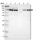 Anti-USP5 Antibody