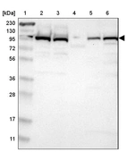 Lane 1: Marker [kDa] 230, 130, 95, 72, 56, 36, 28, 17, 11_br/_Lane 2: Human cell line RT-4_br/_Lane 3: Human cell line U-251MG sp_br/_Lane 4: Human plasma (IgG/HSA depleted)_br/_Lane 5: Human liver tissue_br/_Lane 6: Human tonsil tissue