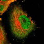 Immunofluorescent staining of human cell line U-251 MG shows localization to nucleoplasm & cytosol.
