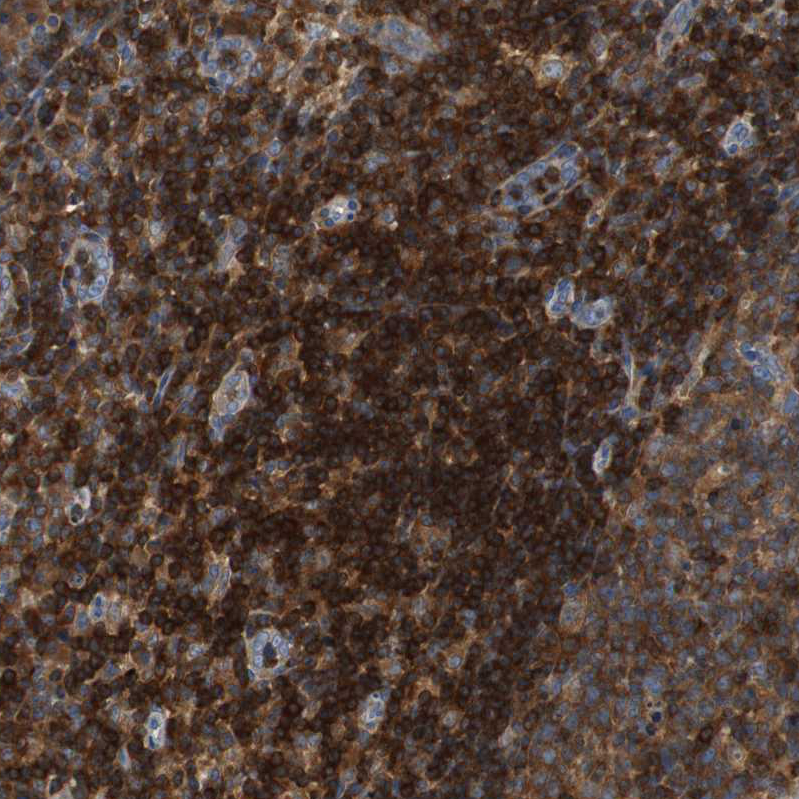 Anti-TSC22D4 Antibody