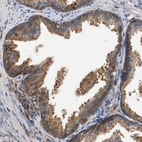 Immunohistochemical staining of human prostate shows moderate cytoplasmic positivity in glandular cells.