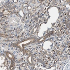 Immunohistochemical staining of human kidney shows weak cytoplasmic positivity in cells in tubules.