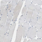 Immunohistochemical staining of human skeletal muscle shows no positivity in myocytes as expected.