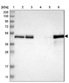 Lane 1: Marker [kDa] 230, 130, 95, 72, 56, 36, 28, 17, 11_br/_Lane 2: Human cell line RT-4_br/_Lane 3: Human cell line U-251MG sp_br/_Lane 4: Human plasma (IgG/HSA depleted)_br/_Lane 5: Human liver tissue_br/_Lane 6: Human tonsil tissue