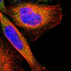 Immunofluorescent staining of human cell line A-431 shows localization to cytosol.