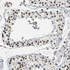 Immunohistochemical staining of human testis shows strong nuclear positivity in cells in seminiferous ducts.