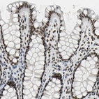 Immunohistochemical staining of human colon shows strong nuclear positivity in glandular cells.