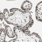 Immunohistochemical staining of human placenta shows strong nuclear positivity in trophoblastic cells.