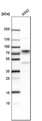 Western blot analysis in human cell line K562.