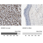 Anti-ACAA1 Antibody