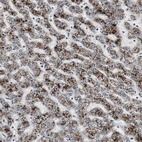Immunohistochemical staining of human liver shows strong granular cytoplasmic positivity in hepatocytes.