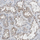 Immunohistochemical staining of human kidney shows strong granular cytoplasmic positivity in proximal tubules.