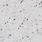 Immunohistochemical staining of human cerebral cortex shows moderate granular cytoplasmic positivity in neuronal cells.
