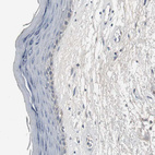Immunohistochemical staining of human skin shows very weak positivity in squamous epithelial cells.