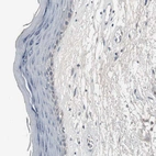 Immunohistochemical staining of human skin shows very weak positivity in squamous epithelial cells.