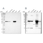 Western blot analysis using Anti-ACAA1 antibody HPA006764 (A) shows similar pattern to independent antibody HPA007244 (B).